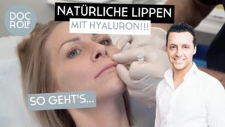 LIPPEN mit Hyaluron NATÜRLICH AUSPRITZEN – so geht's – Dr. Rolf Bartsch